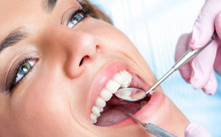 types of dental fillings